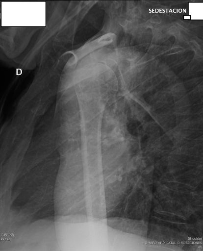 Visualización Anatómica